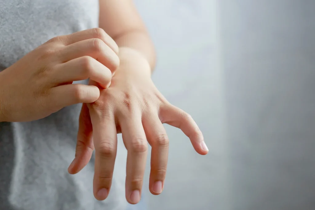 普通のクリームでは治らない？手荒れが悪化する原因